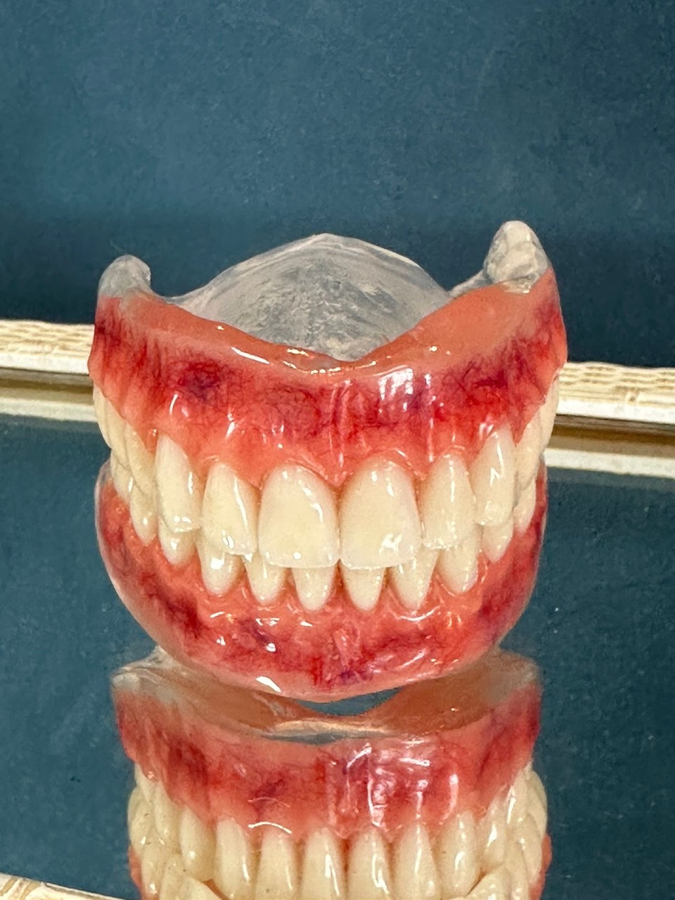 Prótese e Implante Dentário