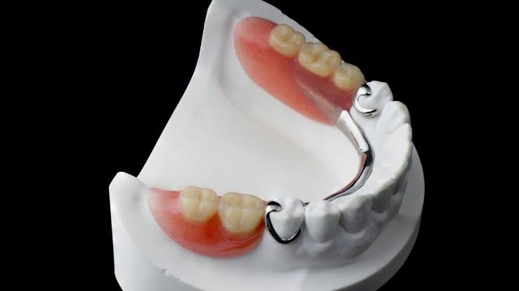 Prótese e Implante Dentário